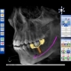 Sirona Dental Systems