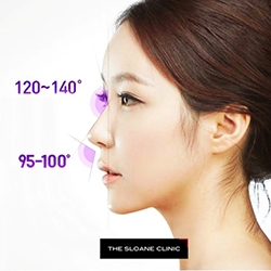 The Sloane Clinic™ Launches 3D Nose Lift; the Latest Non-Surgical Nasal Beautification Technique to Enhance the Nose