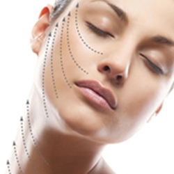 The Sloane Clinic™ Launches the Latest Advancement in Cosmetic Thread-Lifts, Infinity InstaLift