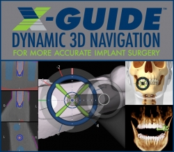 William Linger, DDS, MAGD First Dental Office in Charlotte to Use X-Guide Navigated Dental Implants
