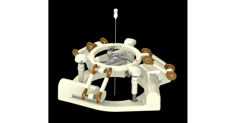 NDR Medical Technology's ANT-X Granted FDA Clearance, Paving the Way for Image-Guided Surgeries - Vimarsana News