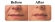 Juvederm Ultra Plus