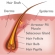 Hair Loss Information