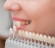 Cosmetic Dentistry NY