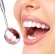 Smile Makeover