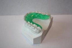 Clear Fusion Orthodontic Hybrid Retainers
