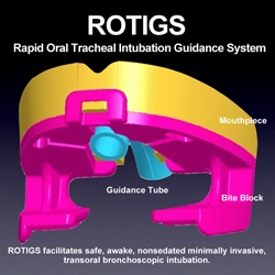 Hanu Surgical Devices’ ROTIGS Intubation Medical Device by Inventor Dr. Brad Napier Demonstrates How Creatively Combining Known Concepts Is Key to Innovation