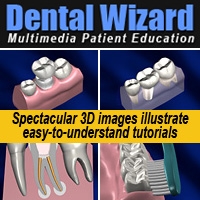 Smile Brands Inc.™ Chooses the Dental Wizard® for Company-Wide Patient Education