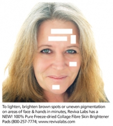 New: Lighten, Brighten Age Spots in 15-Minute Collagen Fibre Treatment