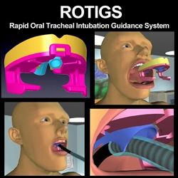 Difficult Airway Emergencies Are Made Easier with Simple ROTIGS Intubation Device and a Little Anesthesia