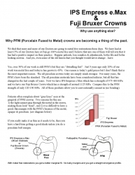 Fuji Dental Lab Shares Why PFM Dental Crowns Are Becoming a Thing of the Past