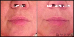 New Skin Cream Can Reduce Nasolabial Folds (Deep Lines at Sides of Nose to Mouth) Major Beauty Blogger Reports