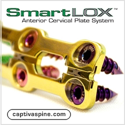 Captiva Spine’s SmartLOX™ Cervical Plate System Receives Clearance for Enhanced and Patented Screw Locking Mechanism