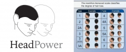 Scalp Micropigmentation SMP Training Now Available in Toronto, Canada by HeadPower Hair Clinic