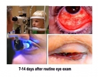 American Safe Sight Foundation (ASF) Urgently Petitions for Safer Eye Care Delivery in US
