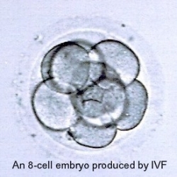 Assisted Reproductive Technology / In Vitro Fertilization (ART / IVF) Success is Lower in Young Women; Its Decline Begins Earlier Than Thought, Occurs at Increasing Rates