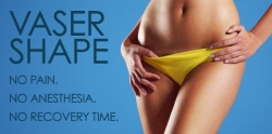 Secret Youth LLC Introduces a New Machine for Cellulite Called Vaser Shape