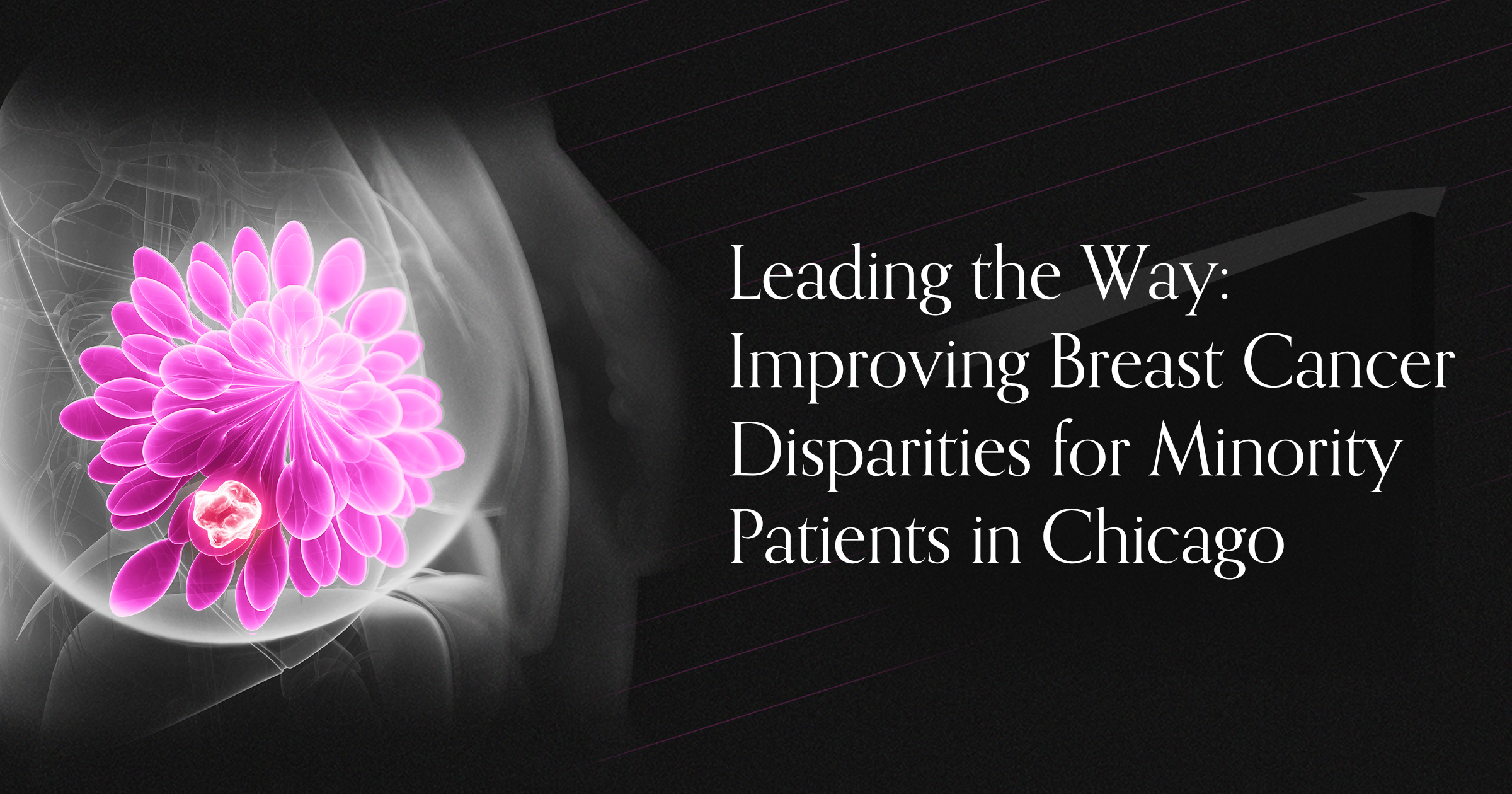 Chicago Leading the Way: New Educational Collaboration Seeks to Create a Clinical Action Plan to Eradicate Racial Disparity Gap in Breast Cancer