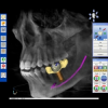 Advanced 3D Imaging Summit for Dentistry to be Held in Columbus, Ohio