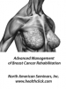 North American Seminars, Inc. Introduces a New Physical Therapy Continuing Education Course, Advanced Management of Breast Cancer Rehabilitation