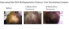 BioRegenerative Sciences Releases Breakthrough Hair Regrowth Product for Women