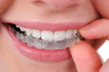 Park Dental Care of NY Runs Summer Special on Invisalign® Orthodontic System in NYC Metro Area