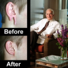 San Francisco Plastic Surgeon, Dr. David Kahn, Offers Surgery to Repair Earlobes After Years of Spacer Use