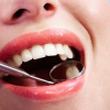 Teeth Whitening Club Offered by New York Dental Spa