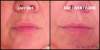 New Skin Cream Can Reduce Nasolabial Folds (Deep Lines at Sides of Nose to Mouth) Major Beauty Blogger Reports