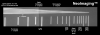 Patent Issued for Low Dose, Ultra-High Definition, and Cinematic X-Ray Imaging Technology