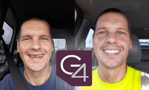 G4 By Golpa - Life Changing Results in 24 Hours