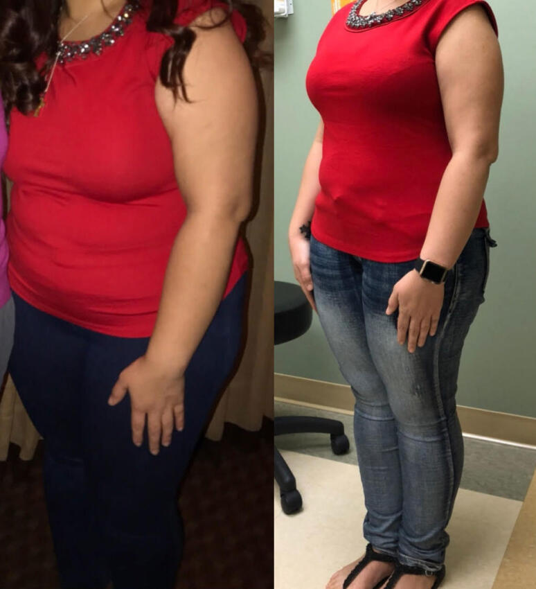 Medical Weight Loss Programs